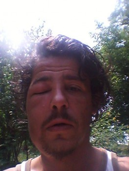 ochi pleznit de albina.jpg